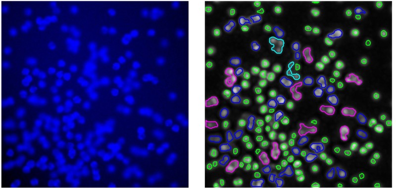 Пример работы метода (справа) на сложном для анализа флюорисцентном изображении (слева): зеленые регионы соответствуют (по мнению метода) отдельным клеткам, синие – группам из двух клеток, фиолетовые из трех, голубые – из пяти.