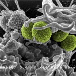 The spread of a drug-resistant form of Methicillin-resistant Staphylococcus aureus (MRSA; pictured above) has captured headlines in recent years, exacerbating fears of an antimicrobial-resistance crisis. Photo: NIAID/NIH.