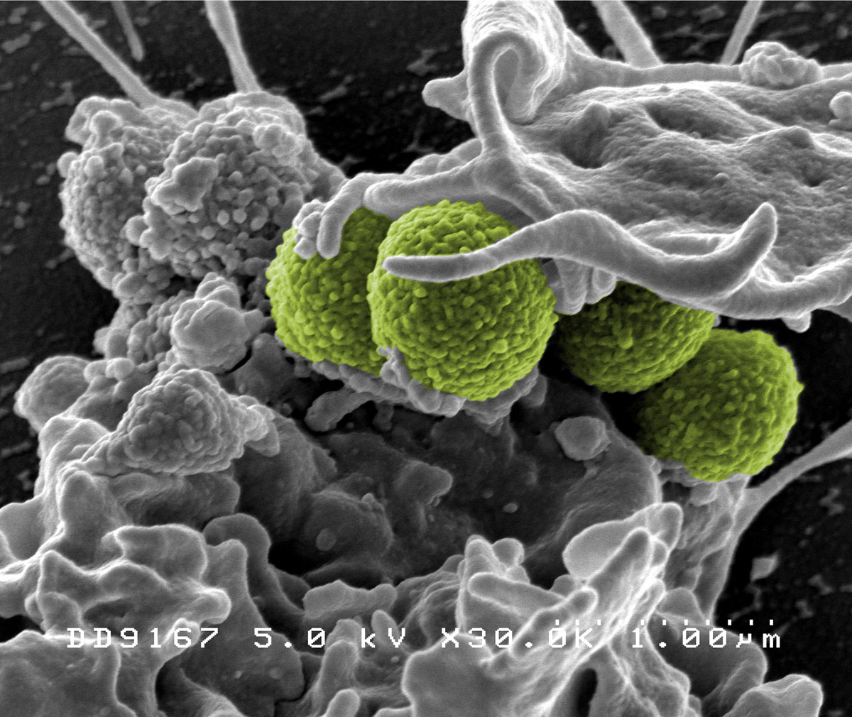 The spread of a drug-resistant form of Methicillin-resistant Staphylococcus aureus (MRSA; pictured above) has captured headlines in recent years, exacerbating fears of an antimicrobial-resistance crisis. Photo: NIAID/NIH.