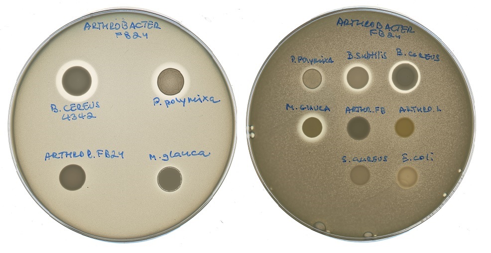 Petri dishes exhibiting bacterial reactions to different types of antibiotics. The inhibition of bacterial growth can be observed in the halos surrounding some of the antibiotics. Photo: Svetlana Dubiley // Skoltech Center for Data-Intensive Biomedicine and Biotechnology.