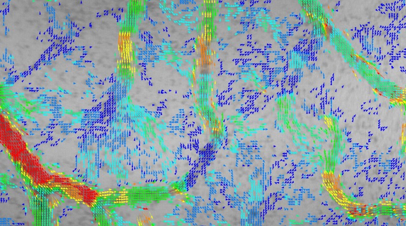 Red blood cell velocity distribution measured and mapped via the new method devised by the Skoltech-SSU team. Each arrowhead corresponds to one cell, with the velocity color-coded from blue (slow) through green (moderate) to red (fast). Credit: Maxim Kurochkin/Skoltech