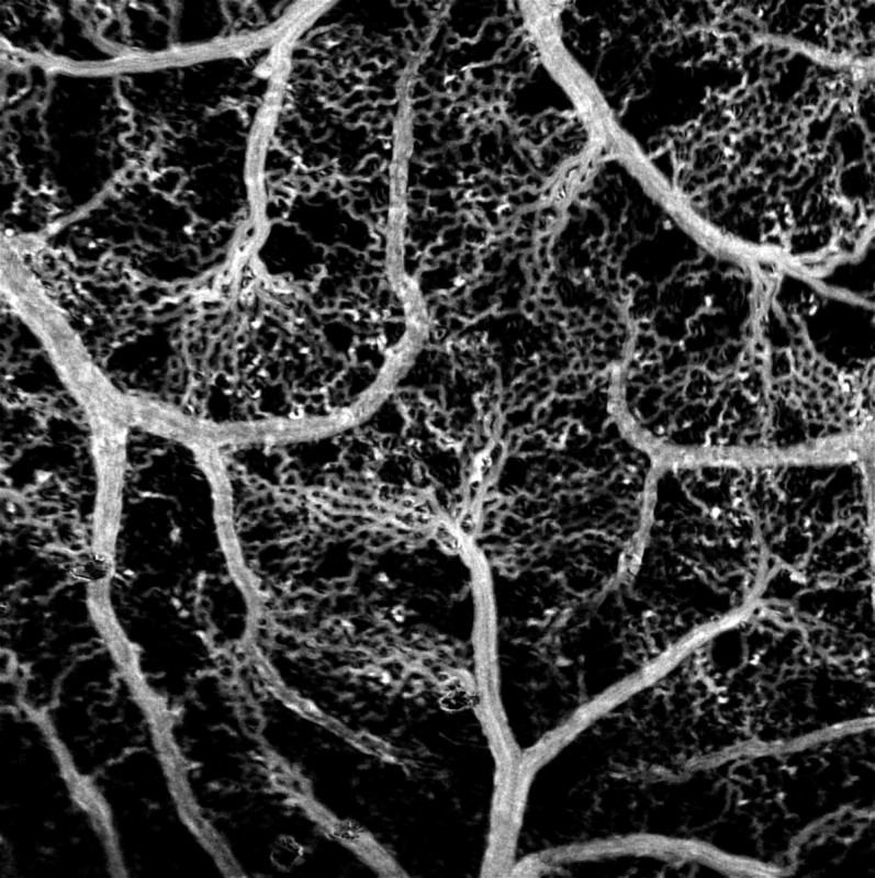 A reconstructed map of the blood vessel network in a chicken embryo obtained by adaptive frame-by-frame threshold filtering of a series of images of moving red blood cells. Credit: Maxim Kurochkin/Skoltech