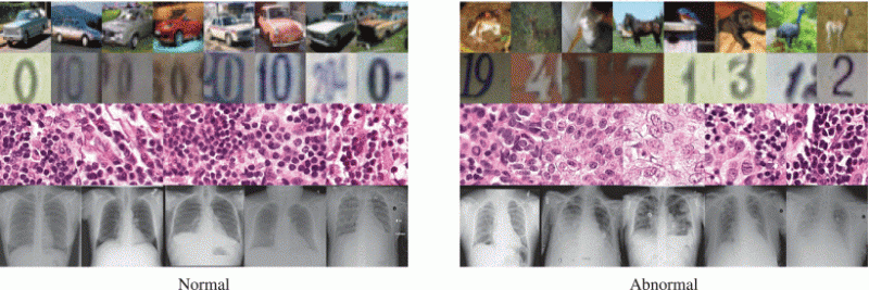 Figure 1. The top two rows show images of cars and digits. Given such data, conventional methods are fairly good at spotting anomalies (right) among ordinary cases (left). The bottom two rows show medical scans — these prove to be more difficult. Credit: Nina Shvetsova et al./IEEE Access