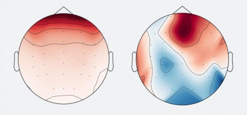 Image. Spatial distribution of electrical activity on the scalp. The left and right picture represent how two different components extracted from the same EEG signal might look. Credit: Gurgen Soghoyan et al./Frontiers in Neuroinformatics