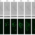 Image. Top row: A colony forming from a single cell of Escherichia coli. The initial cell contains a plasmid that is acted upon by CRISPR-Cas. The bottom row of images shows the same cells viewed with a fluorescence microscope. Green-colored cells contain a plasmid, the rest of the cells are dark — their plasmids have been destroyed by CRISPR-Cas. Credit: Viktor Mamontov et al/PNAS