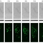 Image. Top row: A colony forming from a single cell of Escherichia coli. The initial cell contains a plasmid that is acted upon by CRISPR-Cas. The bottom row of images shows the same cells viewed with a fluorescence microscope. Green-colored cells contain a plasmid, the rest of the cells are dark — their plasmids have been destroyed by CRISPR-Cas. Credit: Viktor Mamontov et al/PNAS