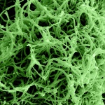 Ebola virus particles. Colorized scanning electron micrograph of filamentous Ebola virus particles budding from a chronically infected VERO E6 cell (35,000x magnification). Photo courtesy of NIAID, Flickr