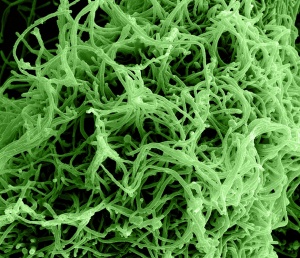 Ebola virus particles. Colorized scanning electron micrograph of filamentous Ebola virus particles budding from a chronically infected VERO E6 cell (35,000x magnification). Photo courtesy of NIAID, Flickr
