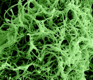 Ebola virus particles. Colorized scanning electron micrograph of filamentous Ebola virus particles budding from a chronically infected VERO E6 cell (35,000x magnification). Photo courtesy of NIAID, Flickr