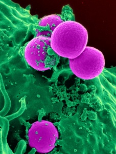 MRSA antibiotics resistant 'superbug' bacteria. Image courtesy of mfablog.ca