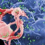 Scanning electron micrograph of HIV-1, colored green, budding from a cultured lymphocyte. Image courtesy of wikipedia