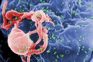 Scanning electron micrograph of HIV-1, colored green, budding from a cultured lymphocyte. Image courtesy of wikipedia