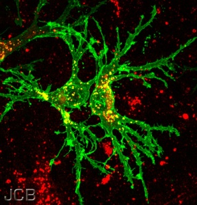 Endosomes are crucial for the cell's functionality. Image courtesy of The Journal of Cell Biology, flickr