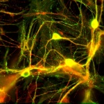 Neuroscience applications are greatly developing world-wide. Image courtesy of sop.infria.fr