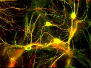 Neuroscience applications are greatly developing world-wide. Image courtesy of sop.infria.fr