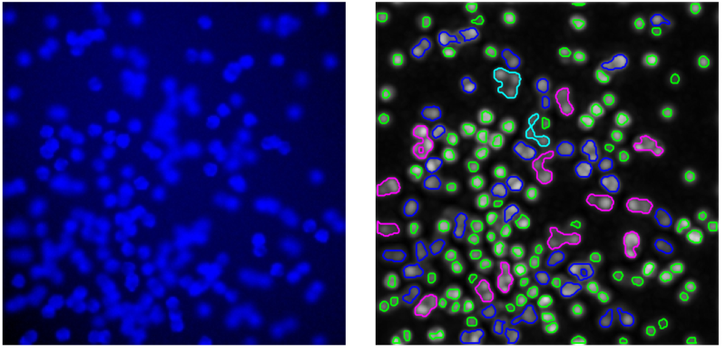 The result of the method (right) on the challenging fluorescence microscopy image (left): according to the method, green regions correspond to solitary cells, blue regions contain two-cell groups, magenta – three-cell groups, and cyan – five-cell groups.