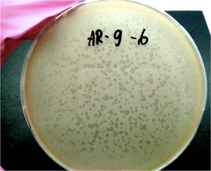 Petri dish with Bacillus